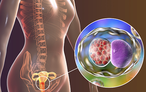 Vaginose et mycose vaginale : comment les prévenir en été ?